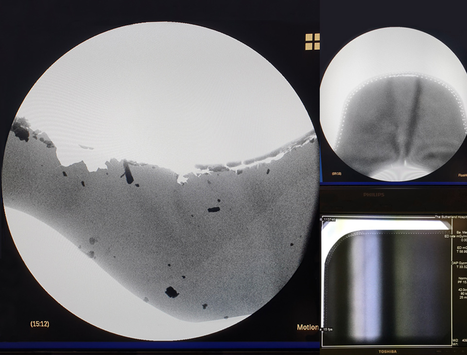 Complete Medical Australasia - Clean & Screen H2 Section Image Screen